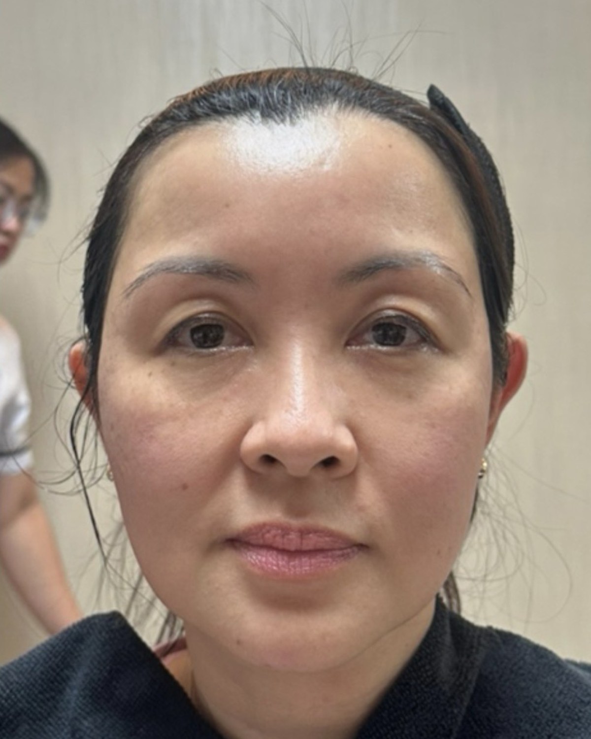 Case 01 after treatment