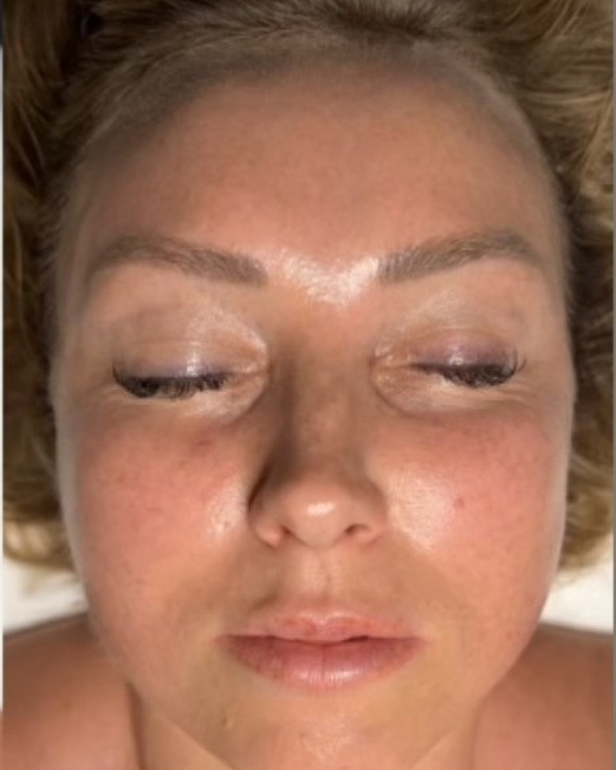 Case 02 after treatment