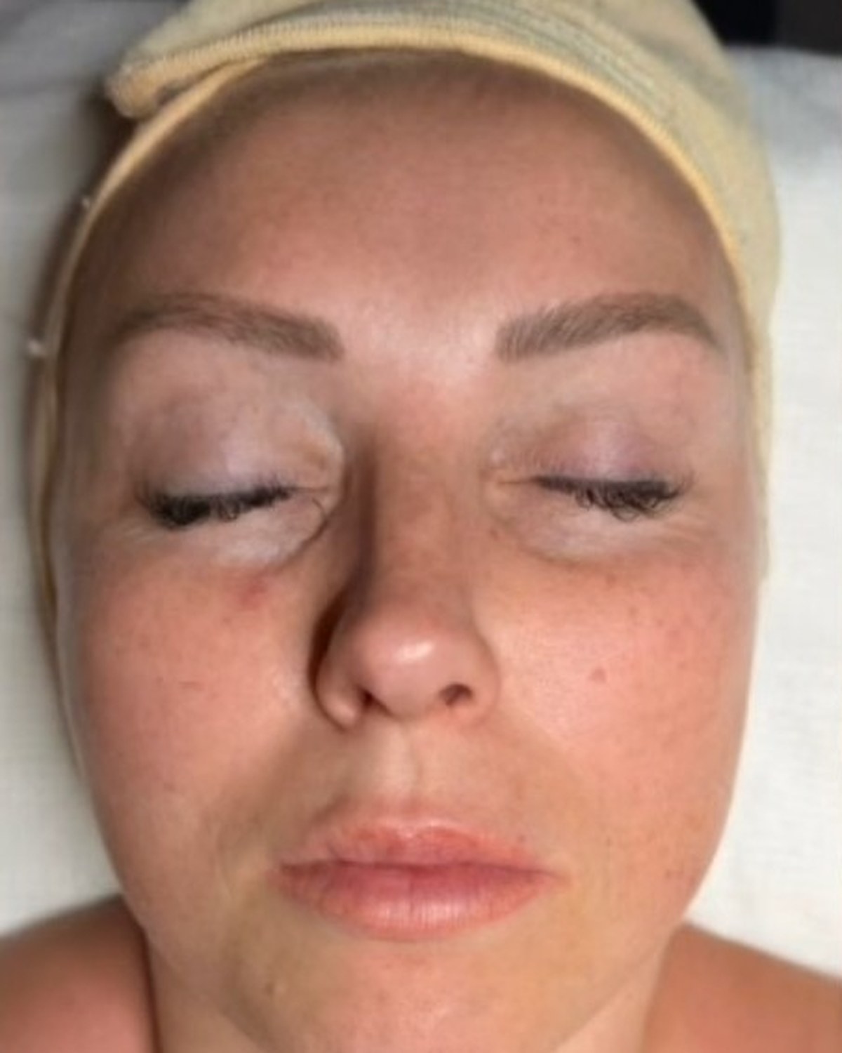 Case 02 before treatment